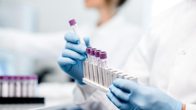 Laboratory assistant putting test tubes into the holder; this is a close-up view focused on the tubes.